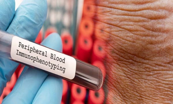 Immunophenotyping Test