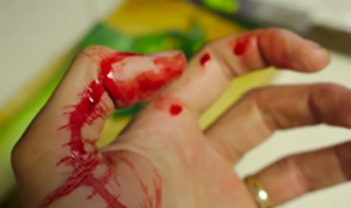 Severe Bleeding First Aid Certification for Emergency Responders
