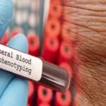 Immunophenotyping Test